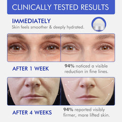Barrita de Akeeronn Firmeza Retinol para manos: hidrata piel seca y revitaliza.
