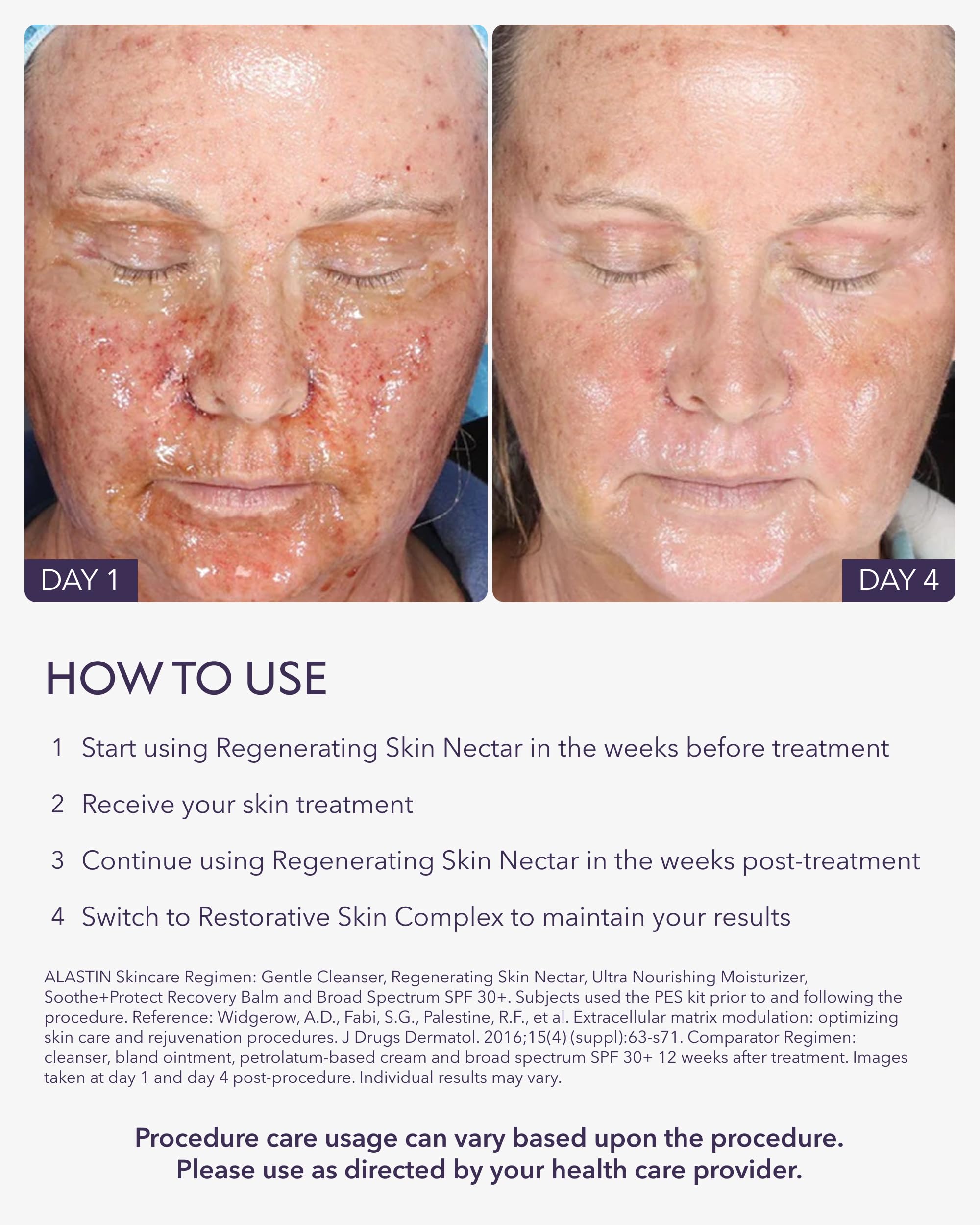 Post-procedure use close-up showing soothing application