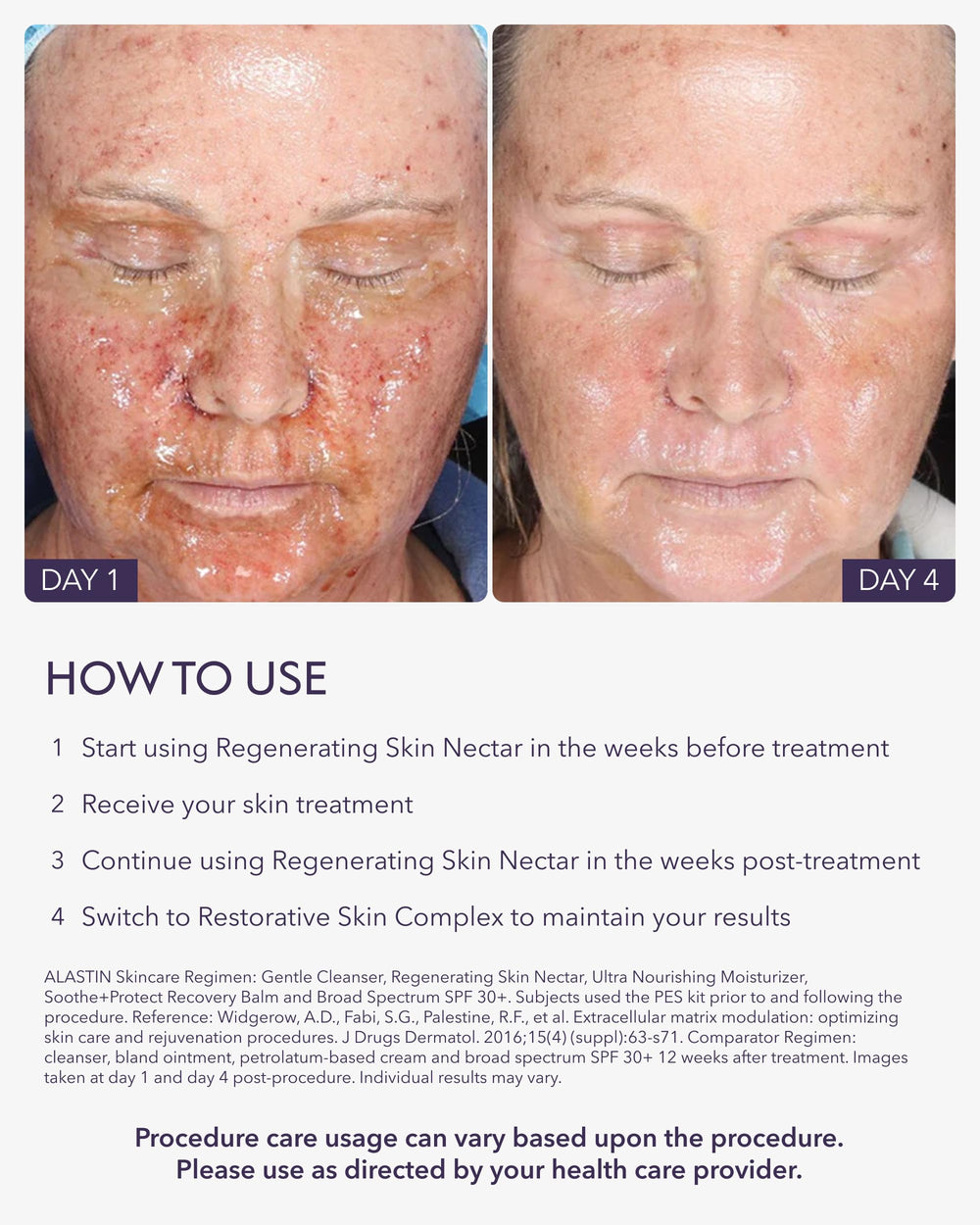 Post-procedure use close-up showing soothing application