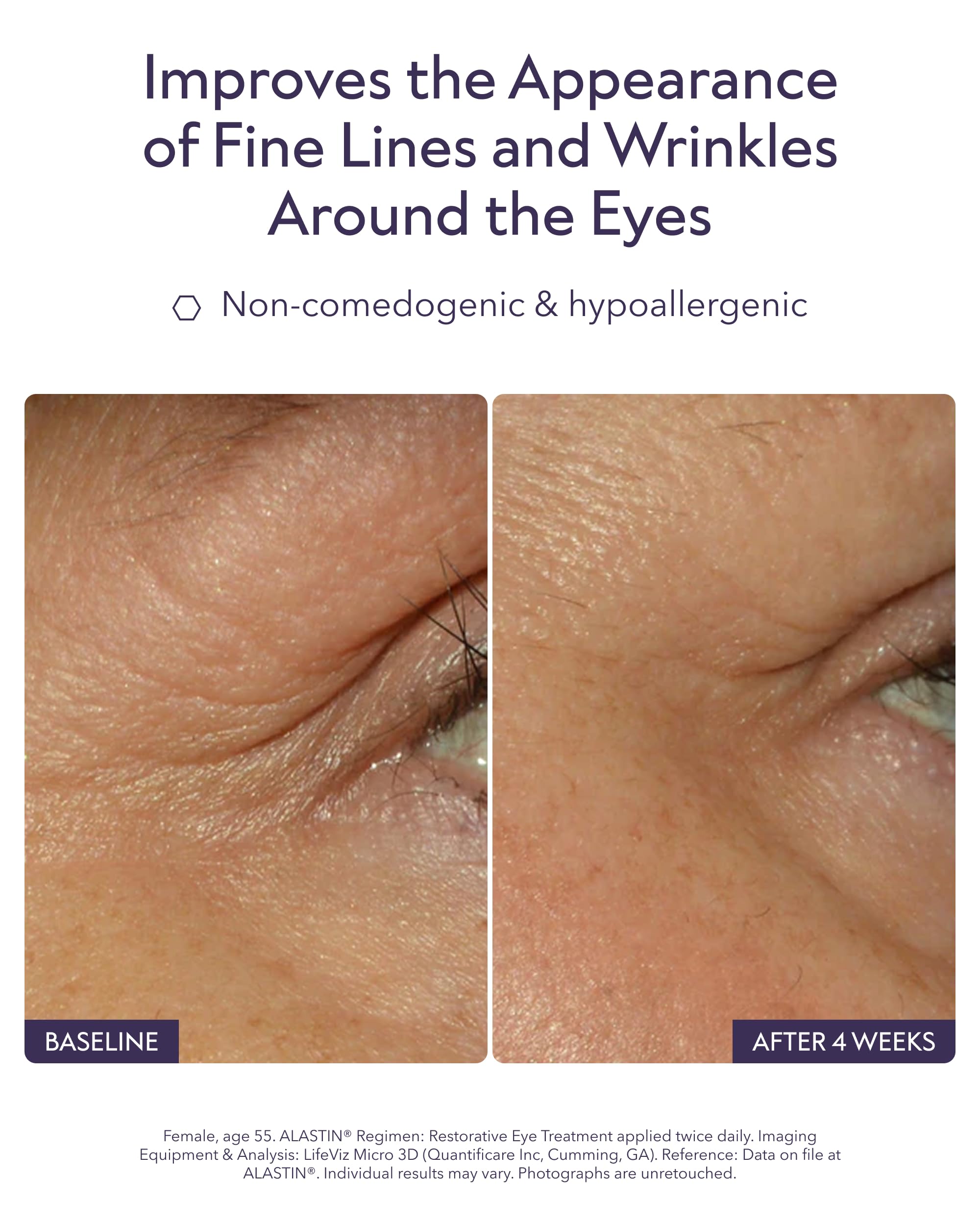 ALASTIN Restorative Eye Complex cream texture swatch on skin, hinting hydration.
