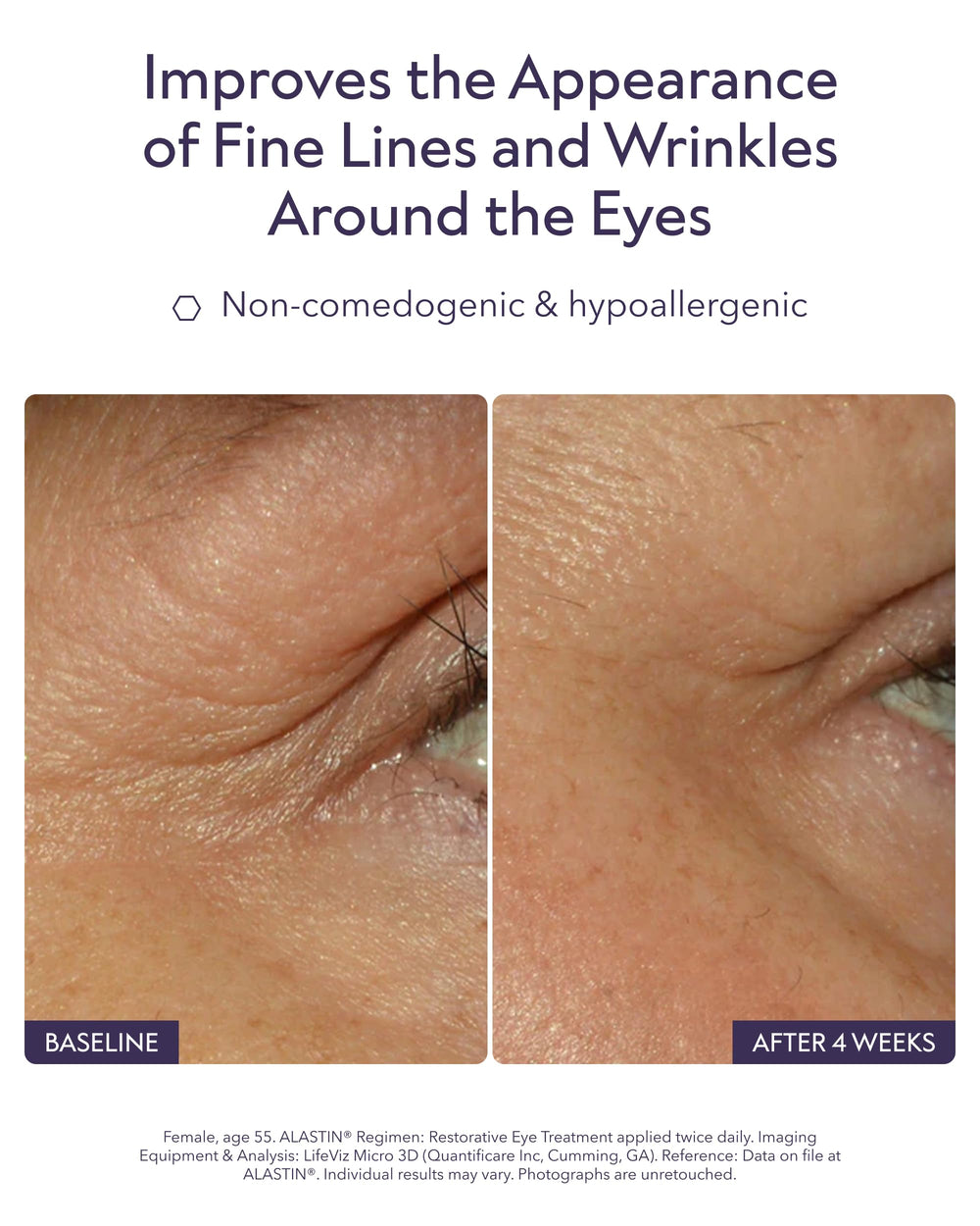 ALASTIN Restorative Eye Complex cream texture swatch on skin, hinting hydration.