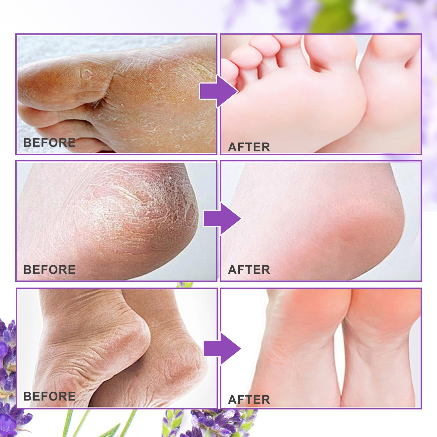 ALIVER before-and-after feet to illustrate potential softening results.