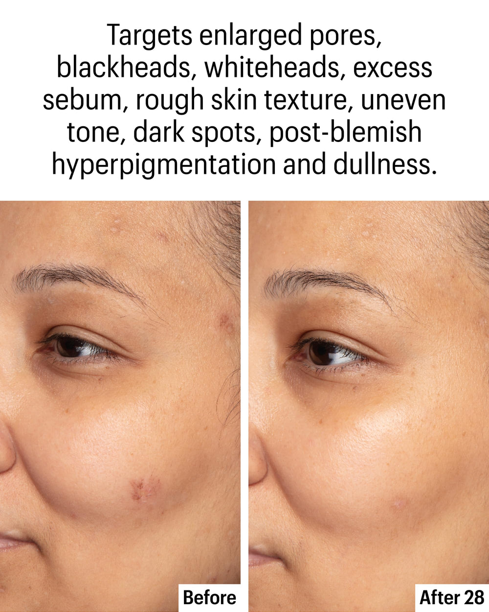 Allies of Skin clarifying serum dispenser pump for easy daily use
