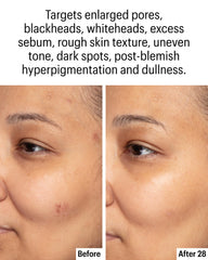 Allies of Skin clarifying serum dispenser pump for easy daily use