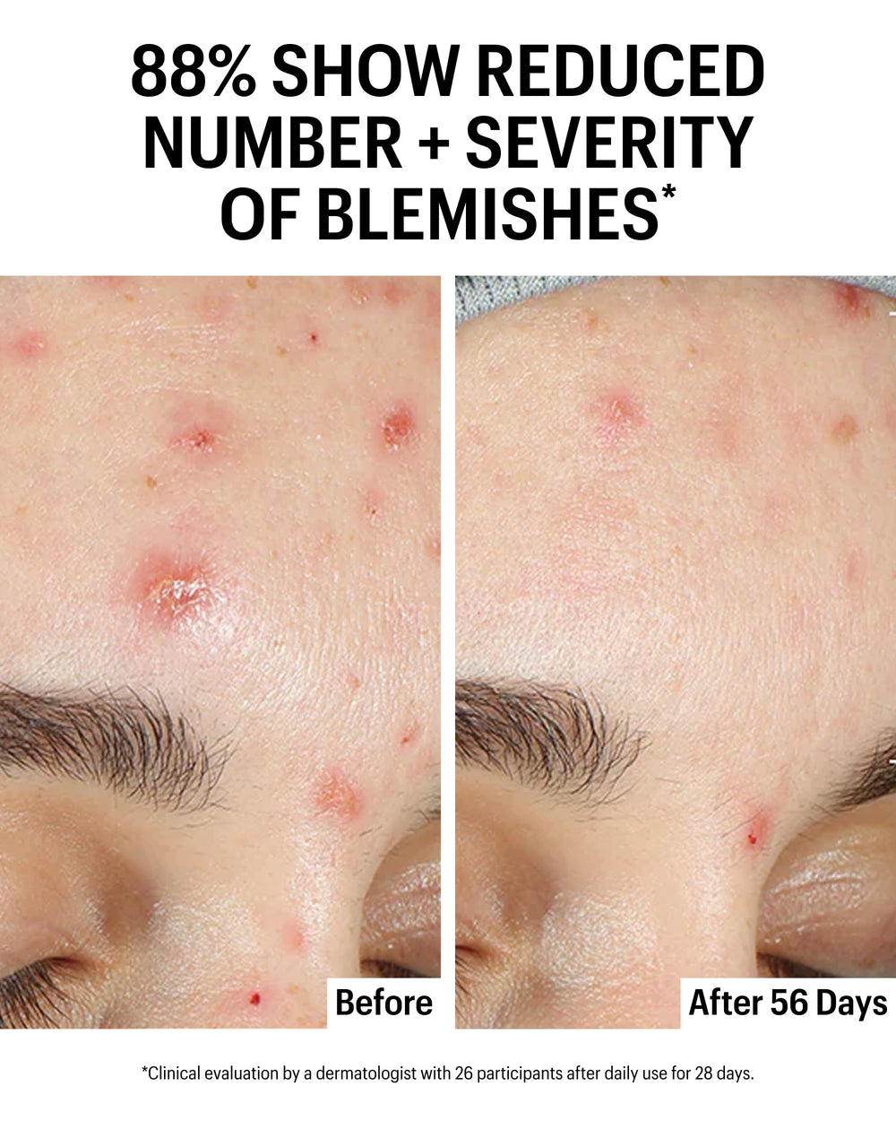 Allies of Skin clarifying serum promotes an even complexion