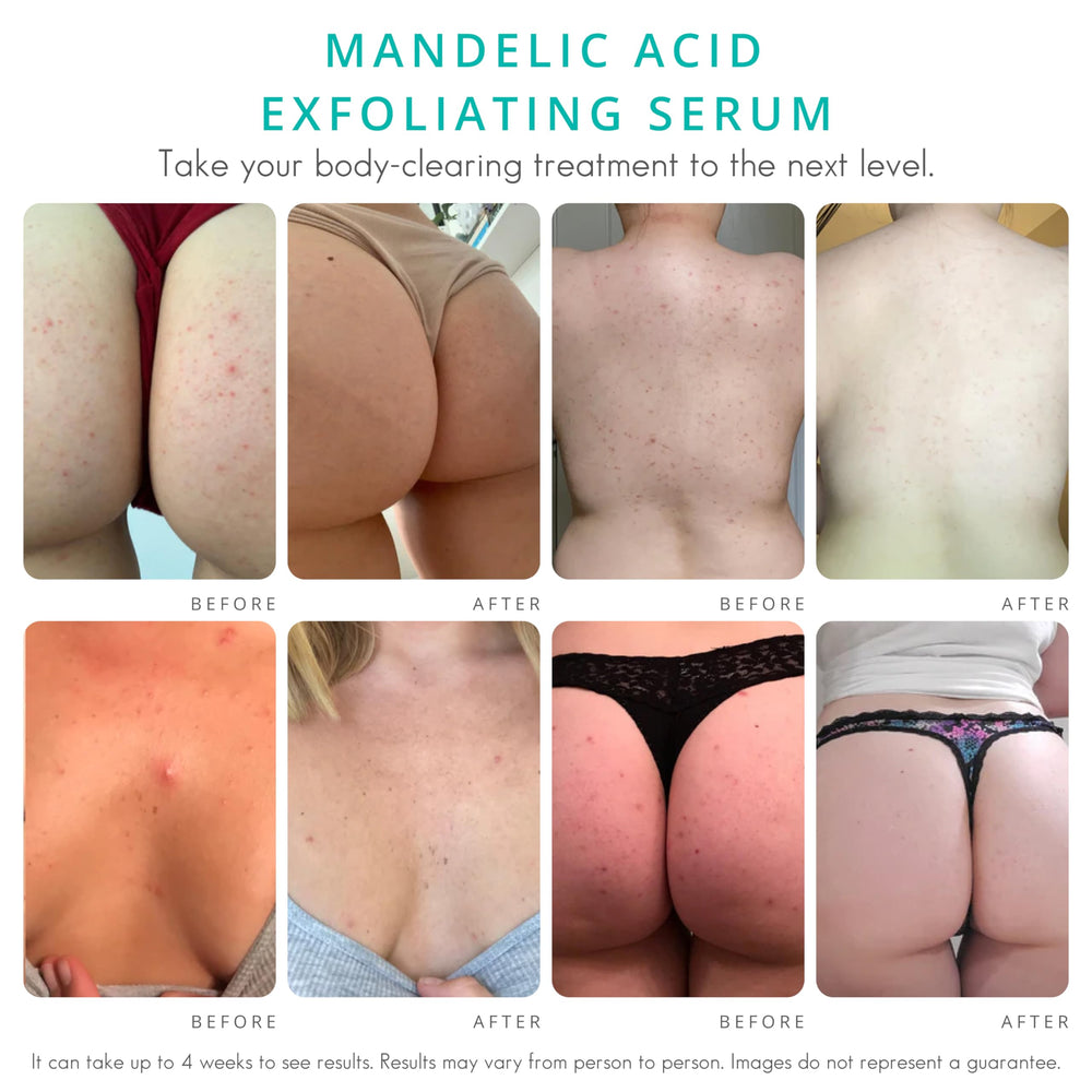 Almond Clear Level 2 Serum texture close-up, mandelic acid for smoother skin.