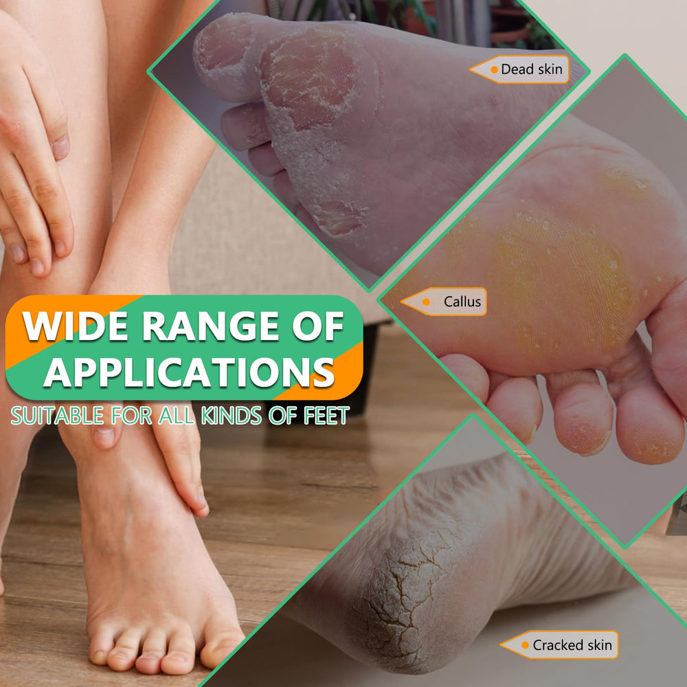 ALOCKMA foot file with wave-structure design reaches curves easily.