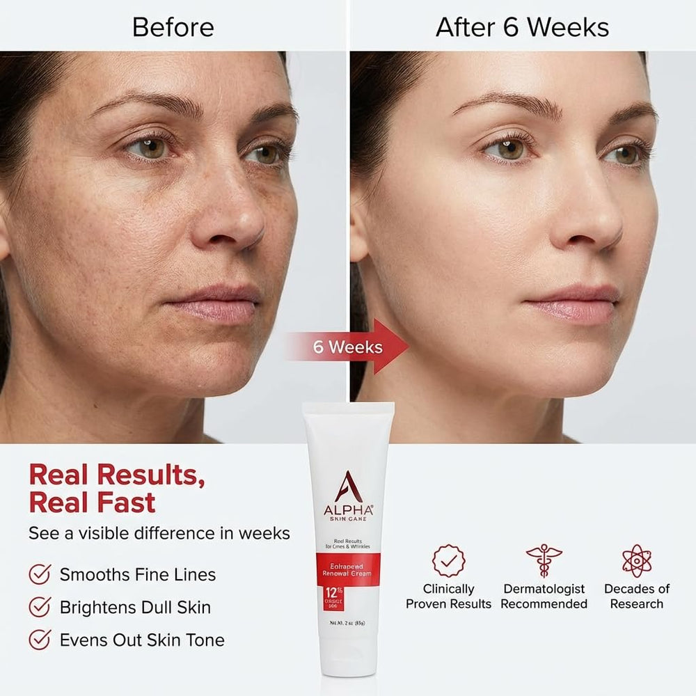 Alpha crema anti edad con ácido glicólico 12: exfoliación suave para piel radiante.