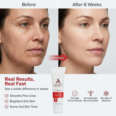 Alpha crema anti edad con ácido glicólico 12: exfoliación suave para piel radiante.