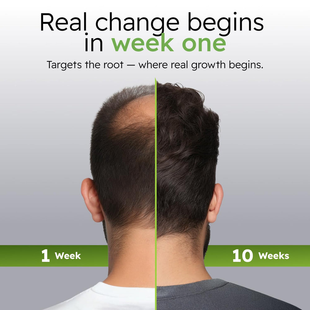 Alphainfuse botanical blend with ginseng and eclipta supports healthier-looking scalp.