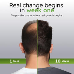 Alphainfuse botanical blend with ginseng and eclipta supports healthier-looking scalp.