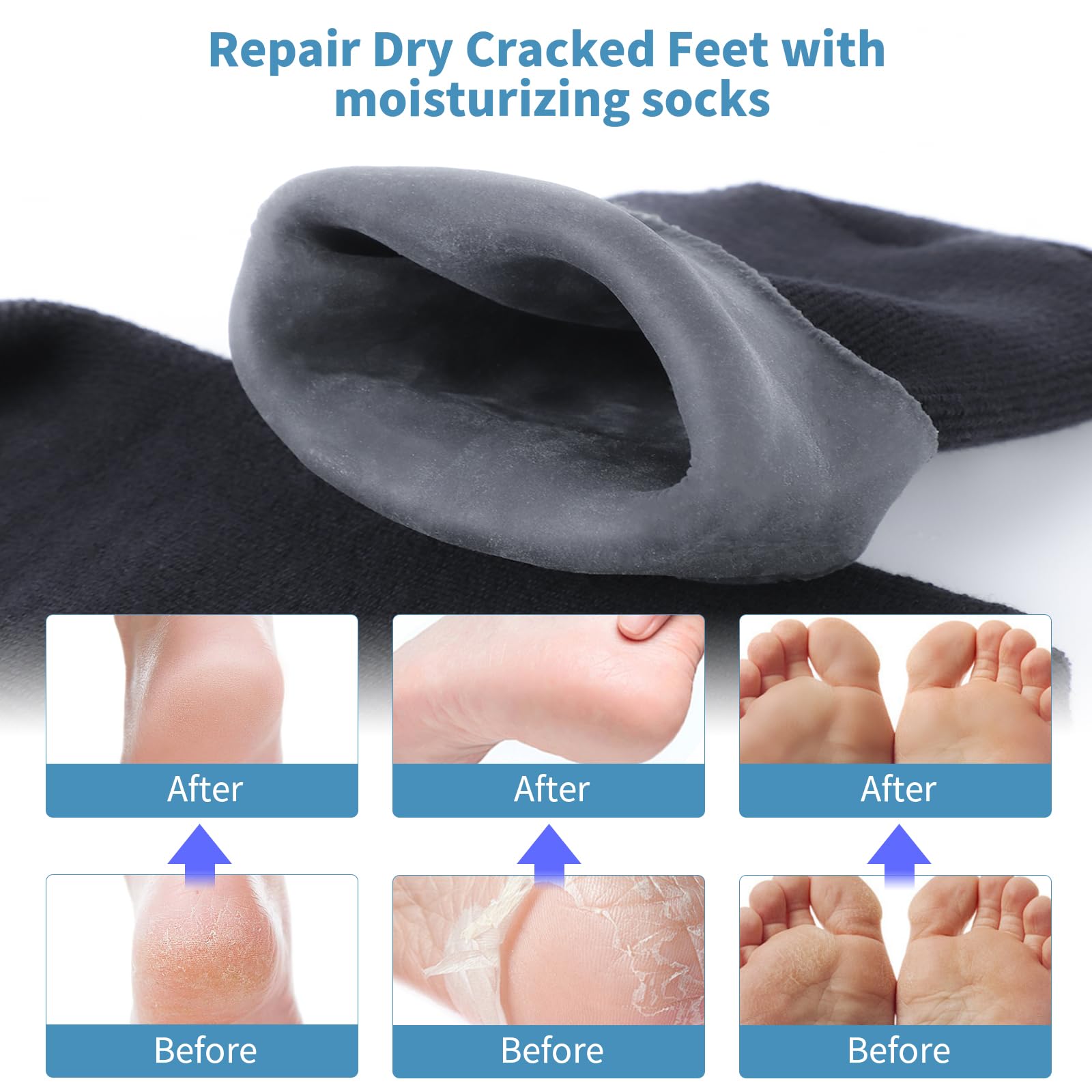 ALUROICE calcetines silicona absorben crema para pies con eficacia
