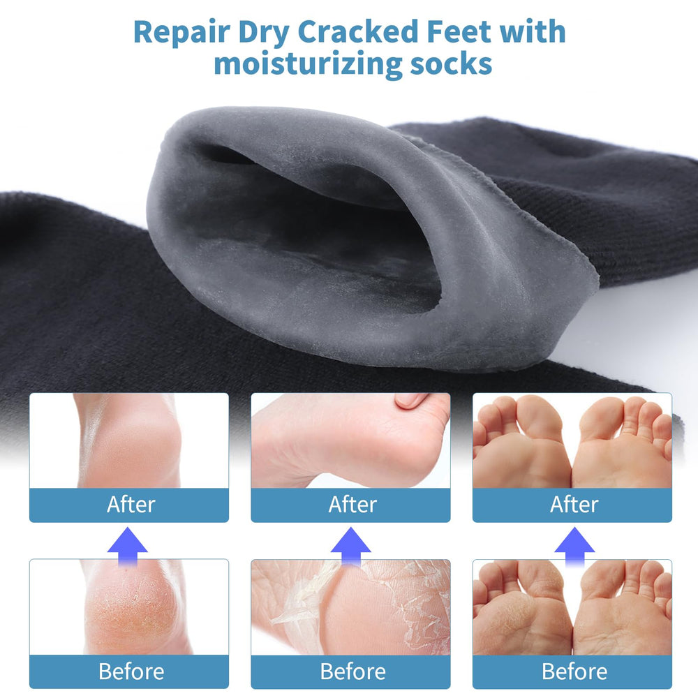 ALUROICE calcetines silicona absorben crema para pies con eficacia