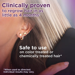 Amazon Basic Care Minoxidil women dropper for precise topical application