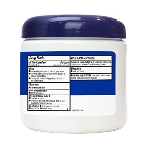 Product shown addressing minor injuries with Amazon Basics Healing Ointment