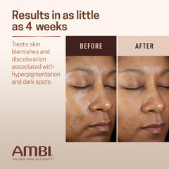 Aplicación diurna de Ambi Even & Clear Advanced Fade Cream con rutina diaria