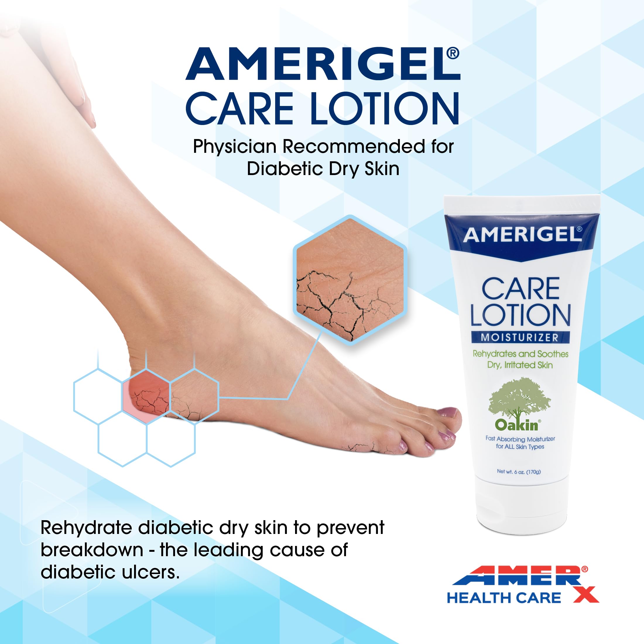 AMERIGEL Care Lotion cuidado para pie diabético con piel sensible.