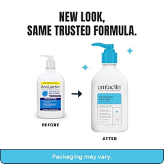 AmLactin 15% lactic acid texture showing gentle exfoliation and skin renewal.