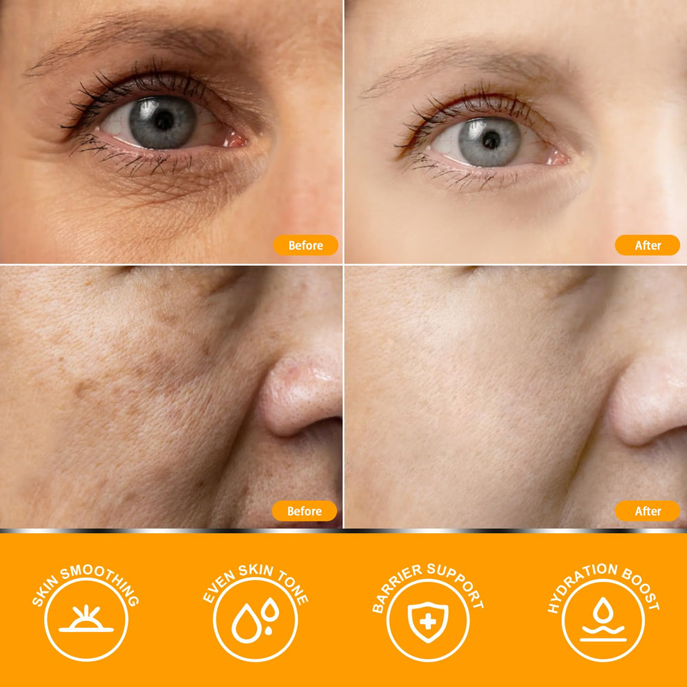 Anroha Vitamina C Serum para uso diario y rutina rápida.