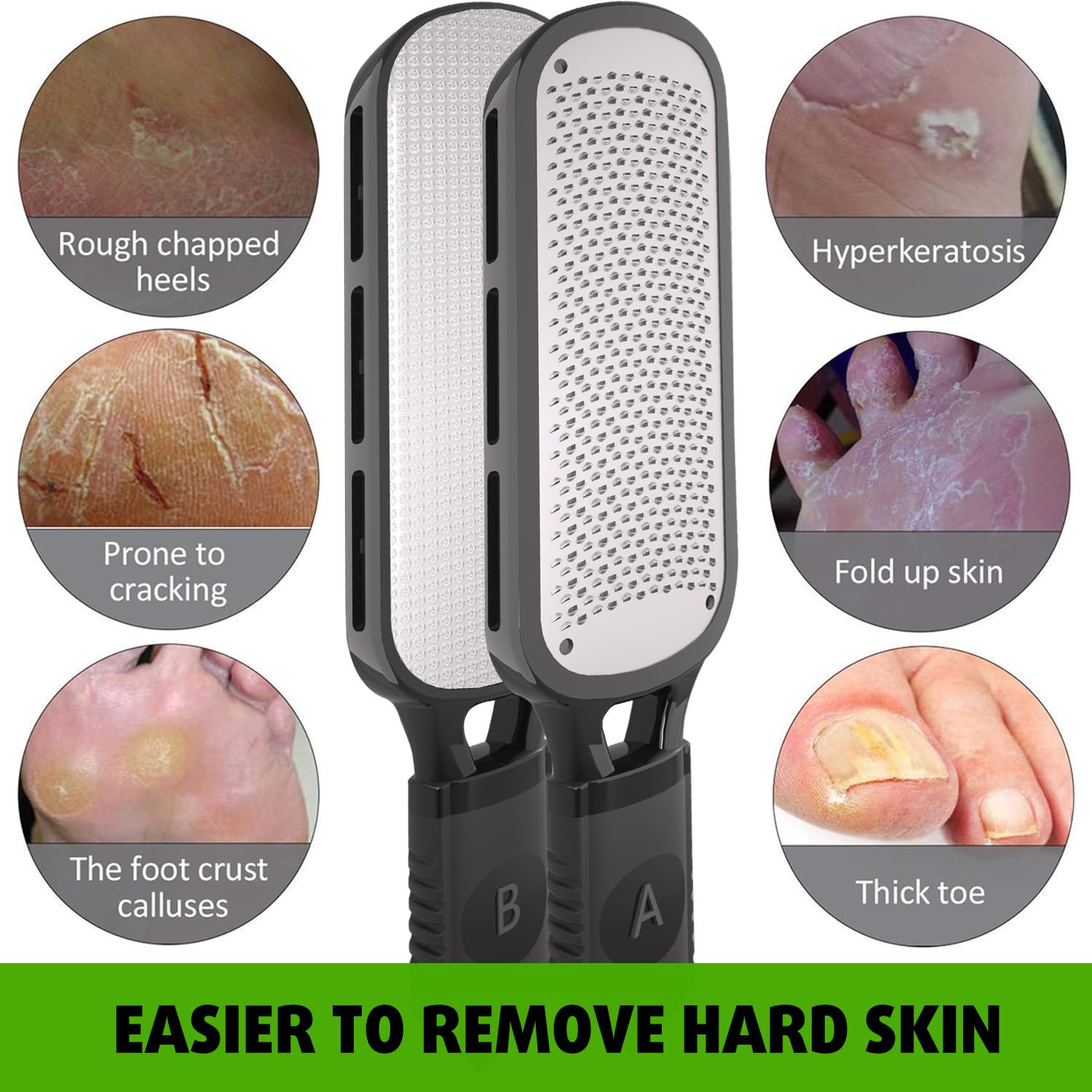 Antonki ergonomic plastic handle ensures secure grip.