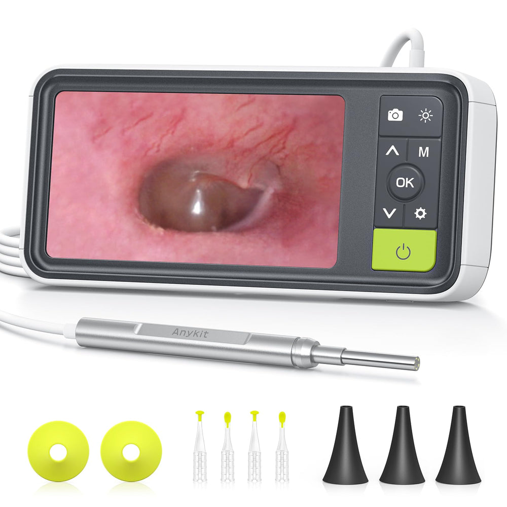 Anykit otoscope with 4.5-inch display shows clear ear visuals for home checks.