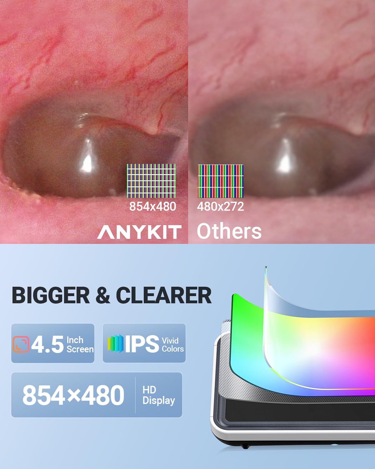 Anykit 6 LED lights illuminate the ear for better image accuracy.