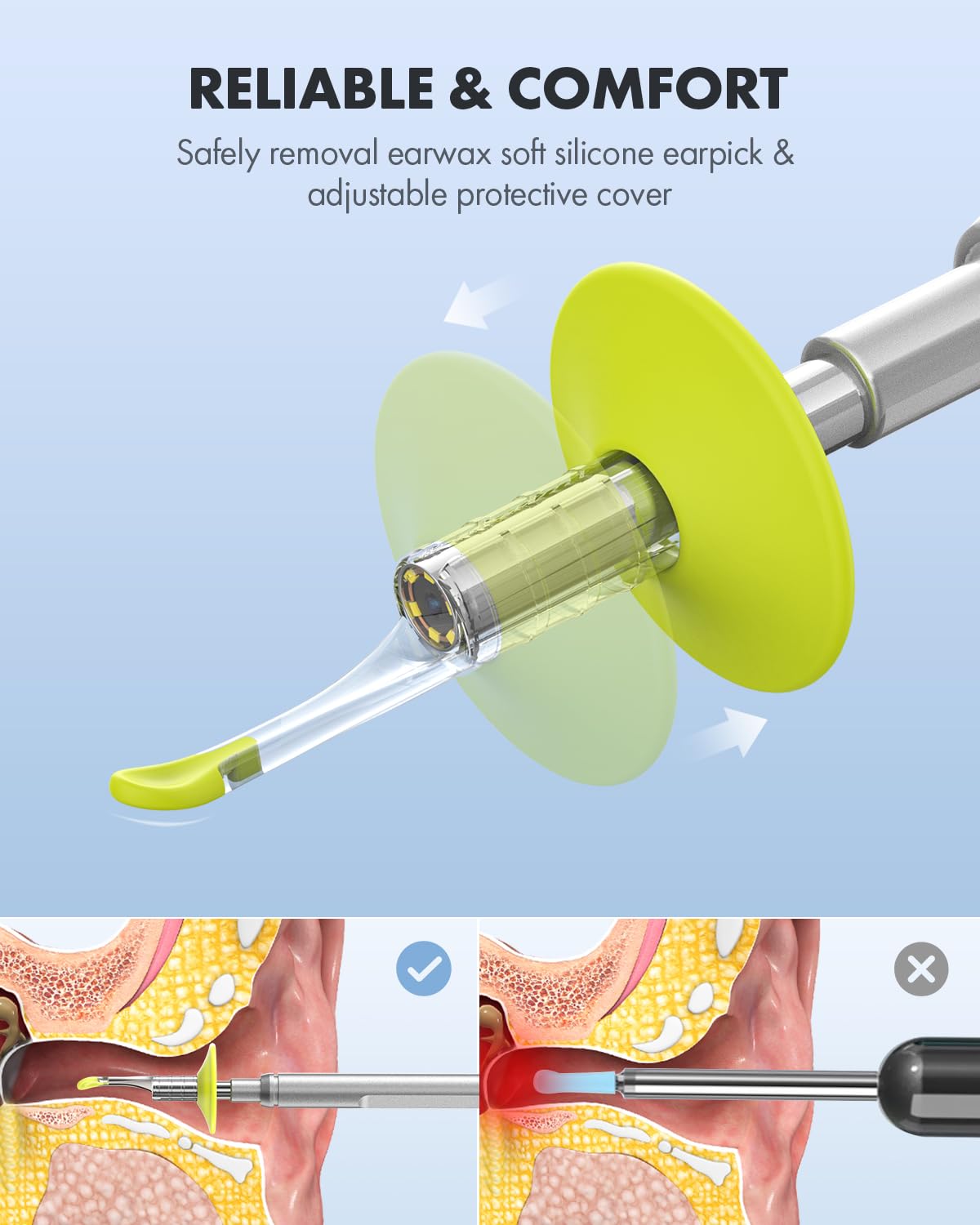 Anykit ear spoons and specula set enables safe earwax removal.