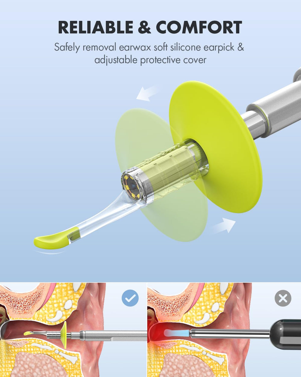 Anykit ear spoons and specula set enables safe earwax removal.