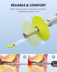 Anykit ear spoons and specula set enables safe earwax removal.