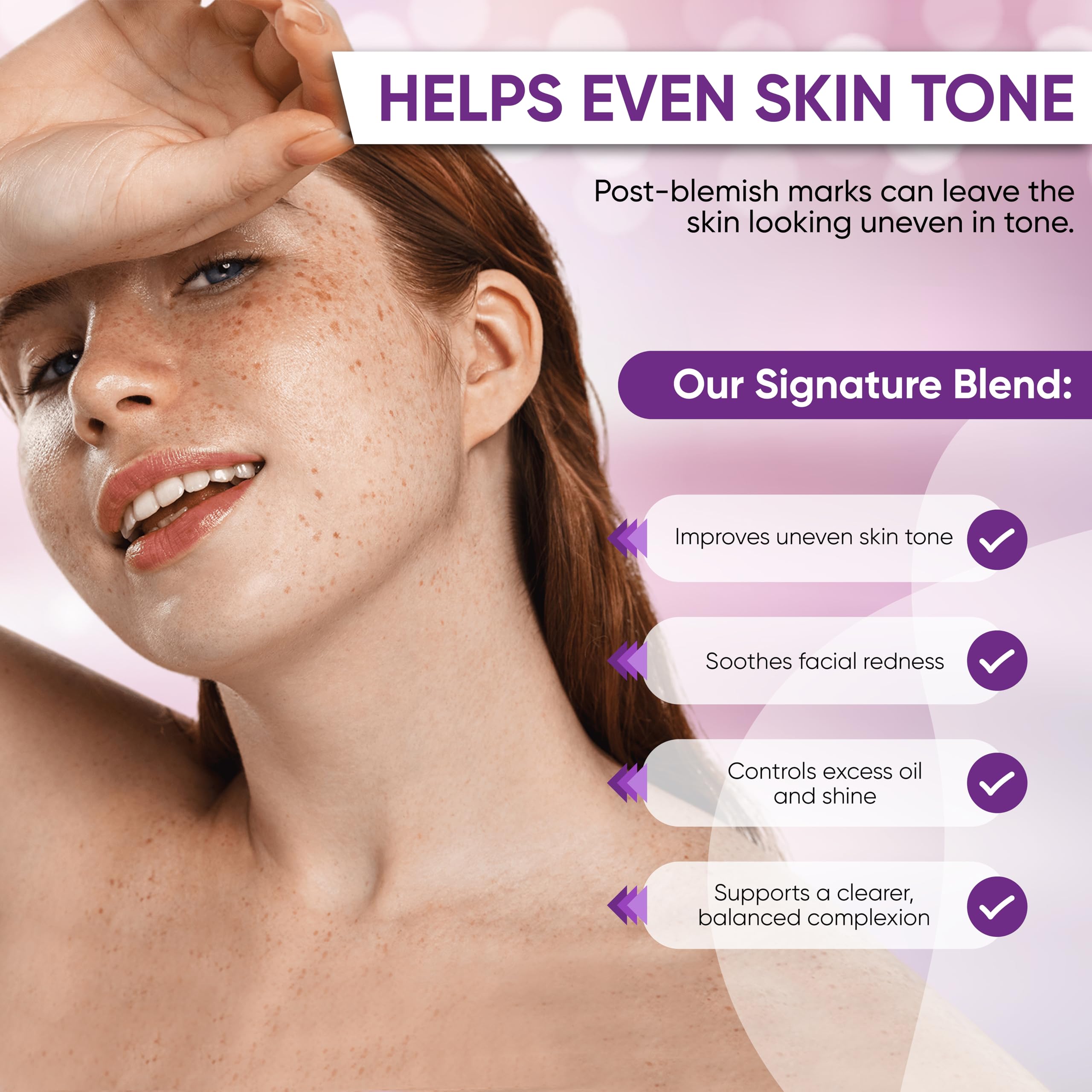 AOBBIY Azelaic Cream on skin displaying even tone and smooth texture