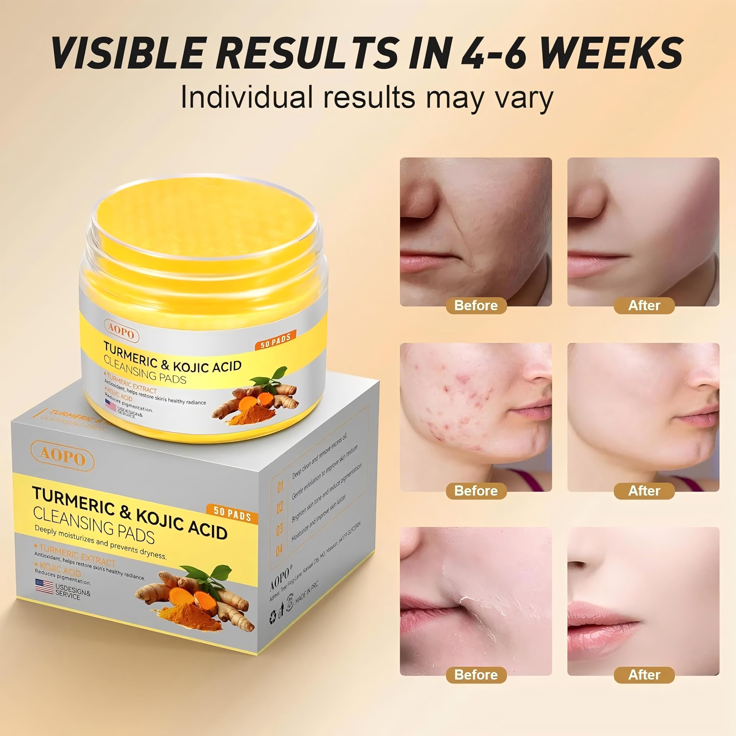 AOPO Kojic Acid and Turmeric Cleansing Pads aloe vera enriched formula for soothing daily cleanse.