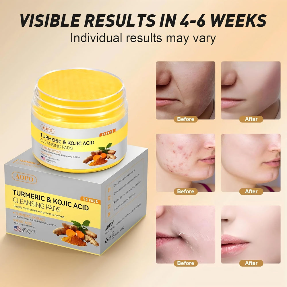 AOPO Kojic Acid and Turmeric Cleansing Pads aloe vera enriched formula for soothing daily cleanse.