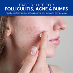 AOSORW crema foliculitis rostro: piel calmada y menos enrojecida.