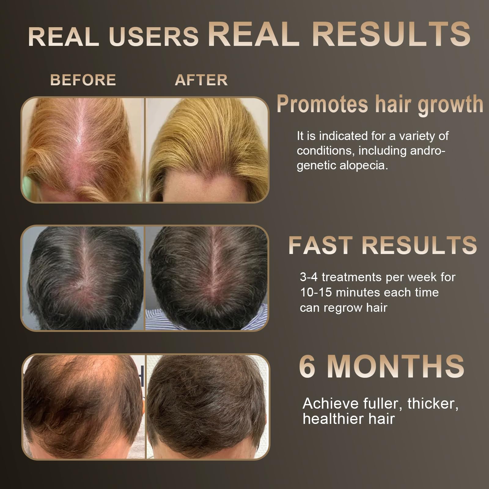 Apbier Laser Hair Growth Comb teeth closeup shows comb action and laser exposure