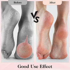 APLZGMG Spa Socks closeup; reusable moisture delivery for daily wear.