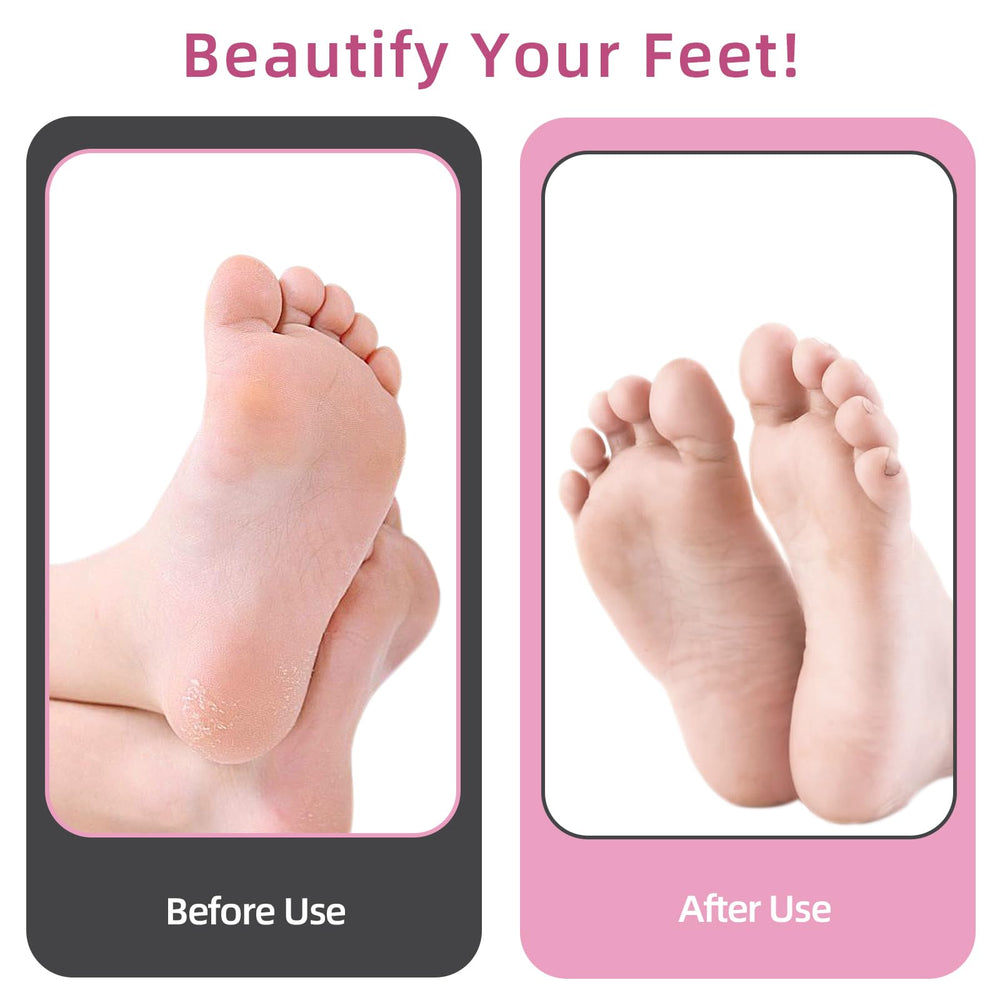 APRELM foot care session demonstrates efficient dead skin smoothing.
