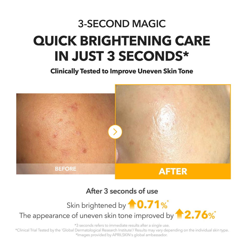 Con APRILSKIN A.C.E Serum, tono más uniforme y claridad.