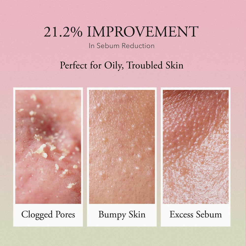 Control del exceso de grasa con el tónico APRILSKIN.