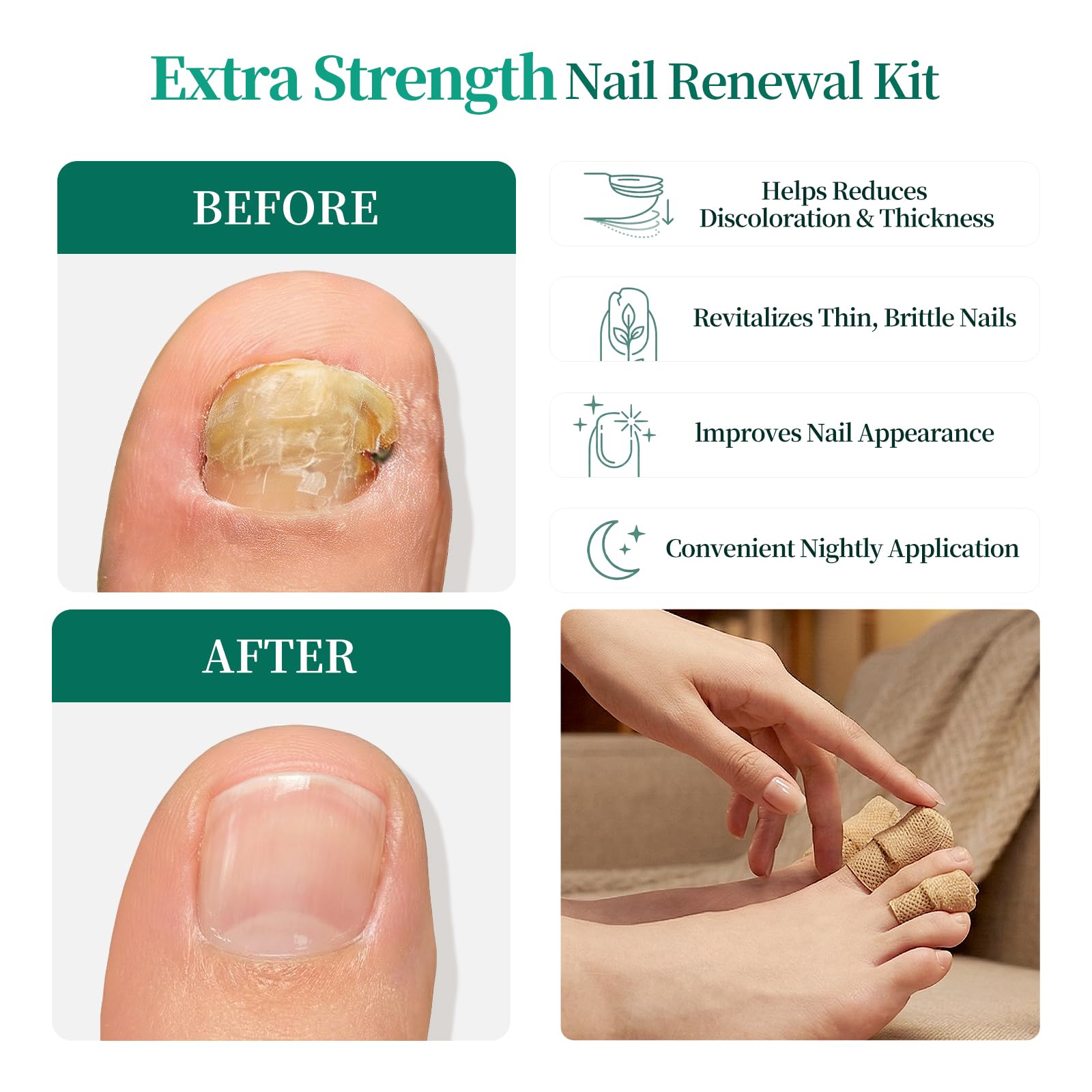 APUREE 8H overnight renewal patch shown applied before sleep