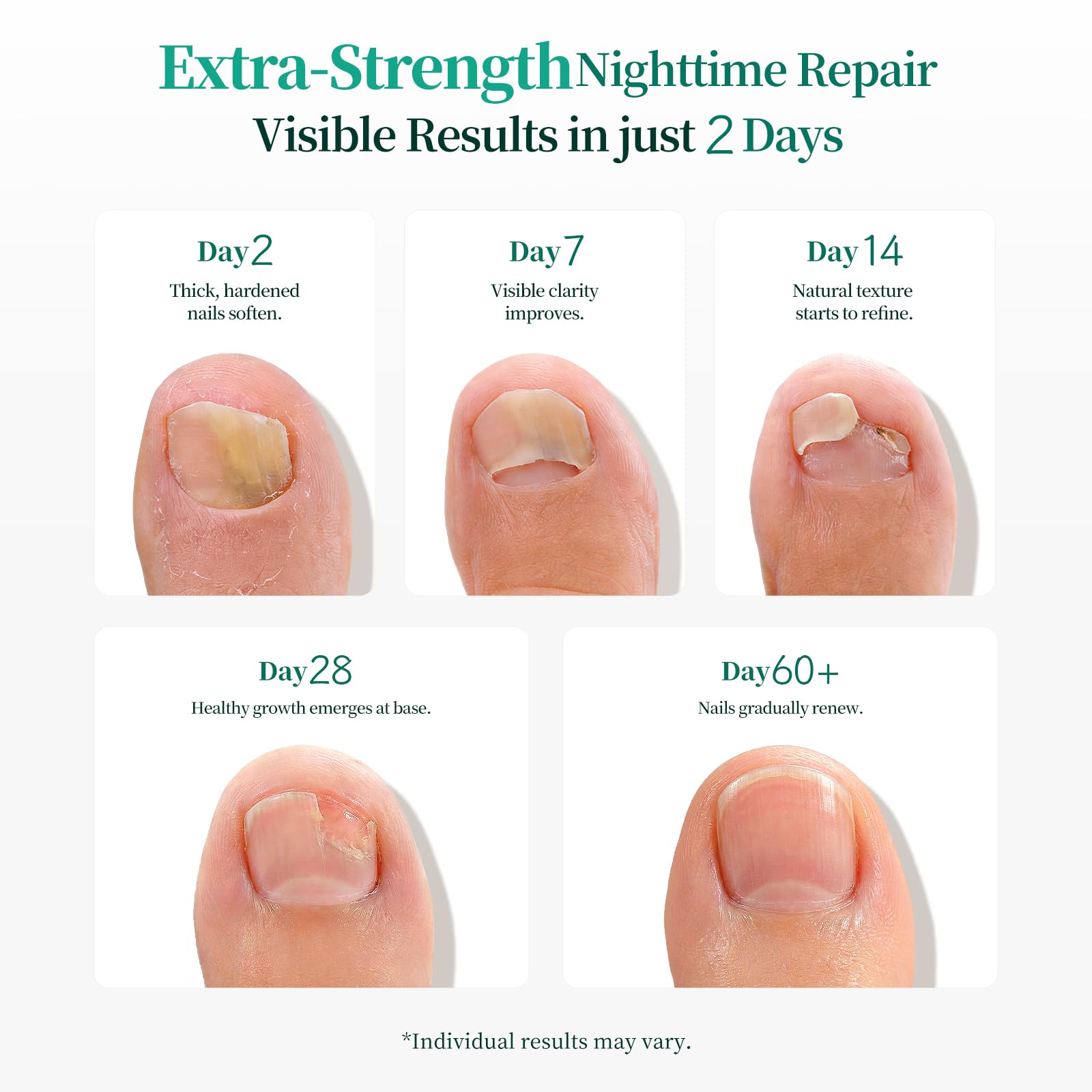APUREE convenient, mess-free nail patch in use