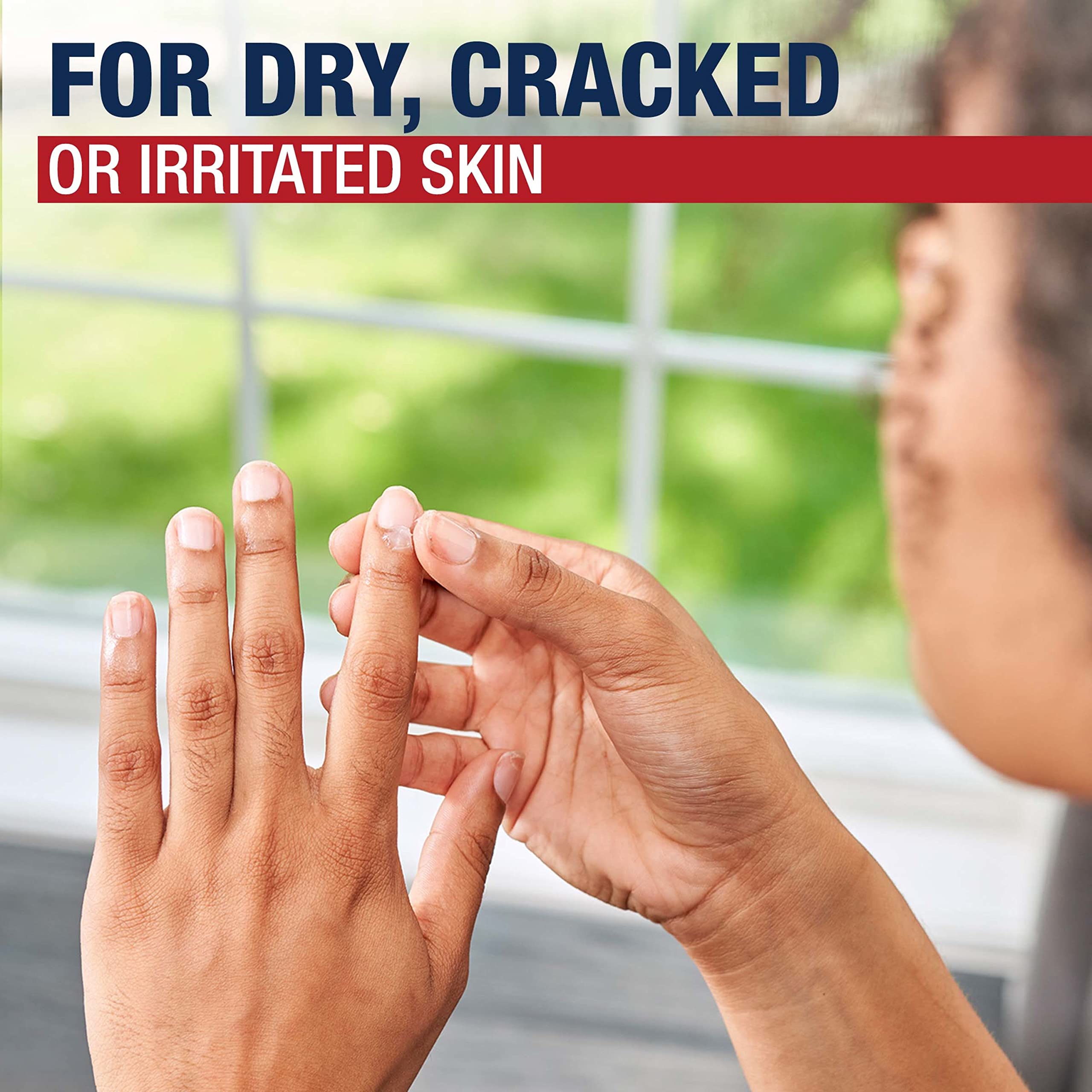 Lips protected with Aquaphor Healing Ointment during weather.