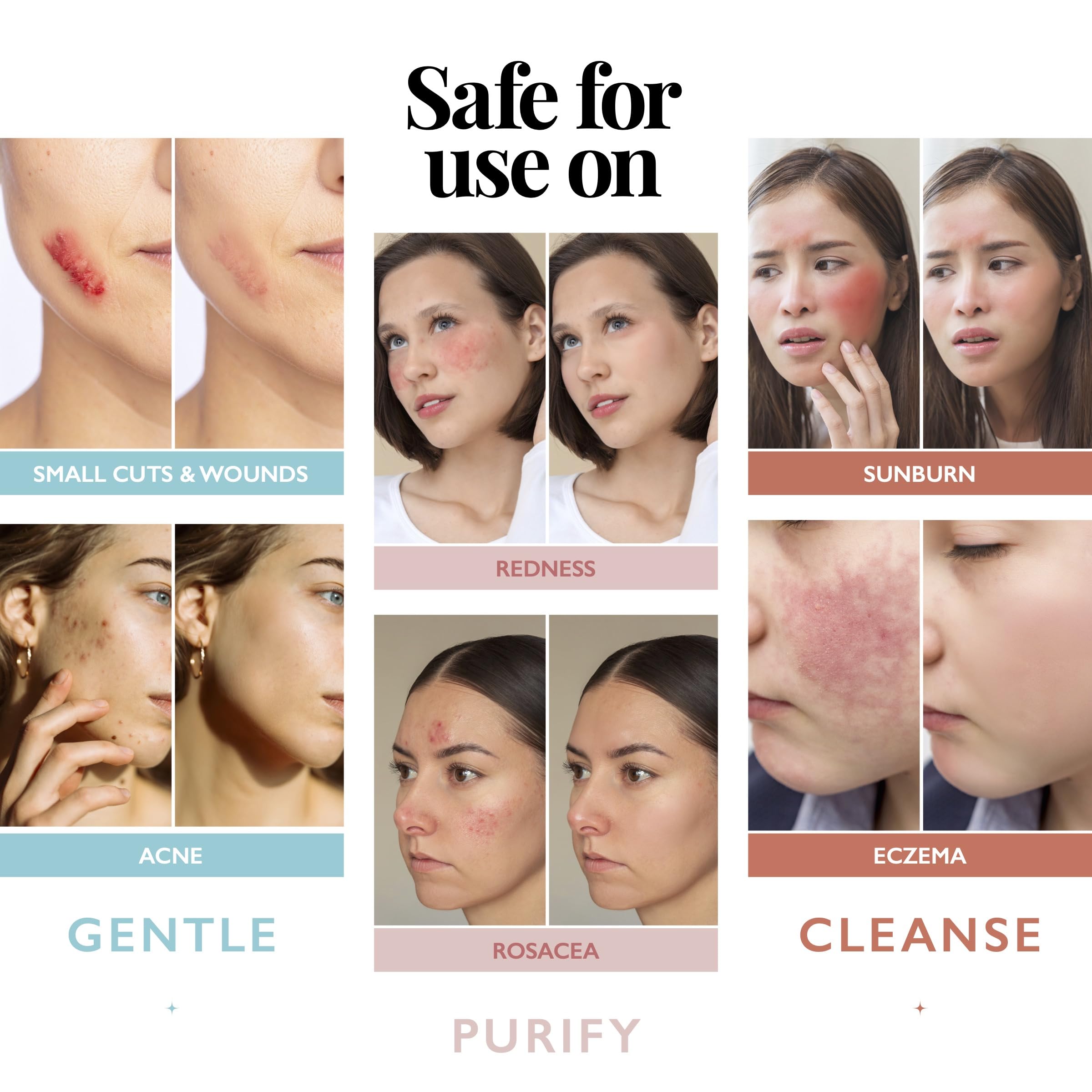 Botella Aquia 8oz lista para uso facial diario