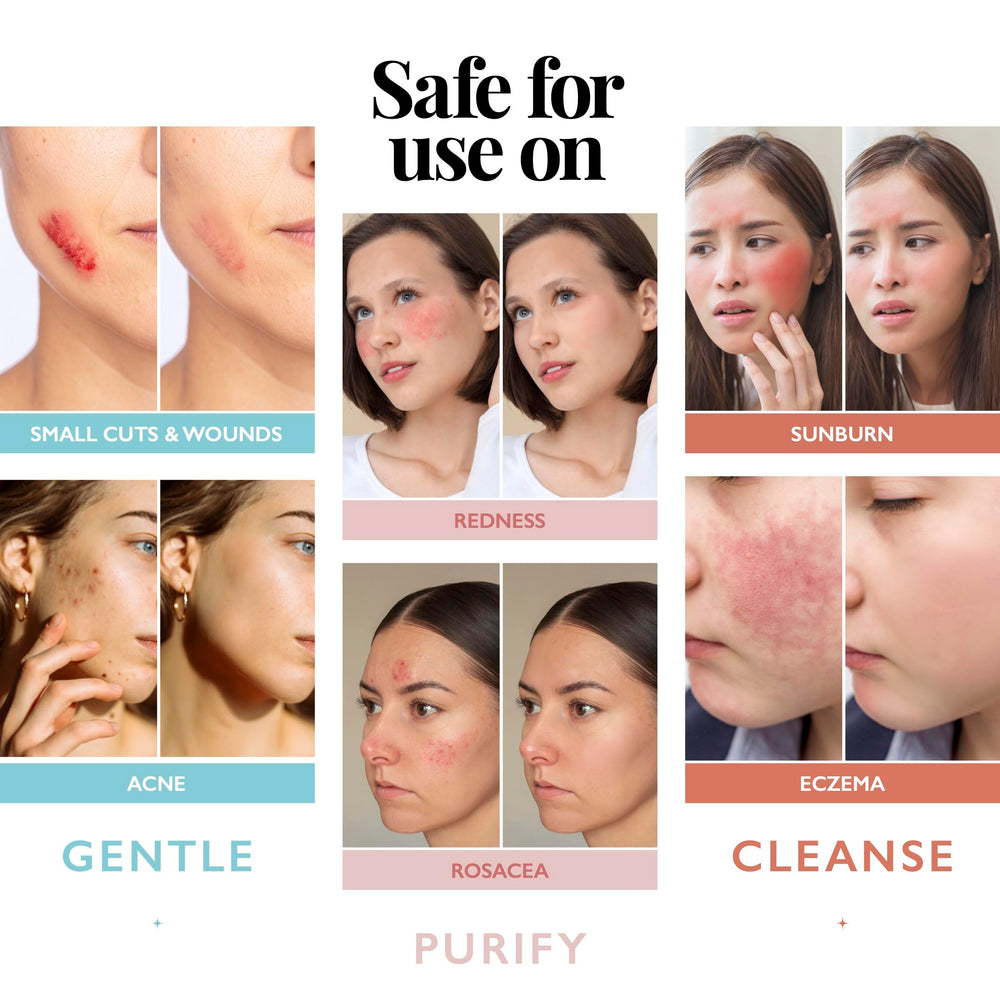 Botella Aquia 8oz lista para uso facial diario