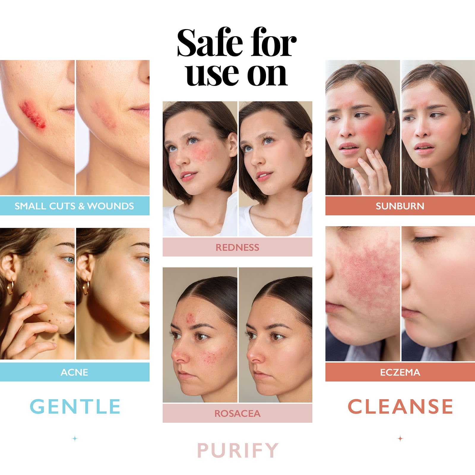 Piercing aftercare with Aquia spray provides soothing post-care