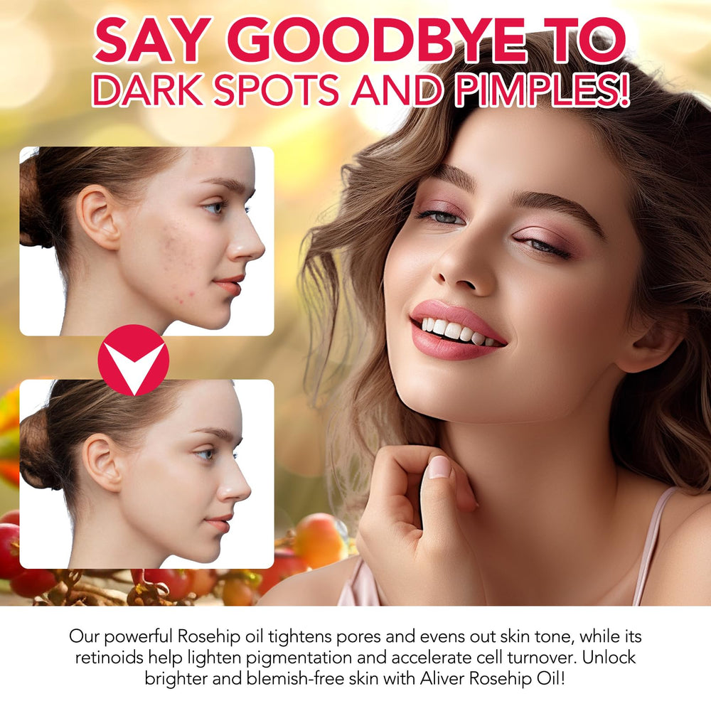 A r b c r n Rosehip oil used on hair for subtle shine.