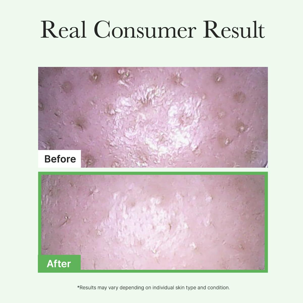 ARENCIA Pore Melt Mochi rice amino acids focus for hydration