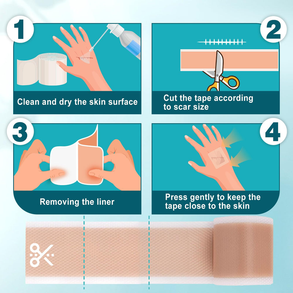 Arme hypoallergenic silicone scar tape material for sensitive skin