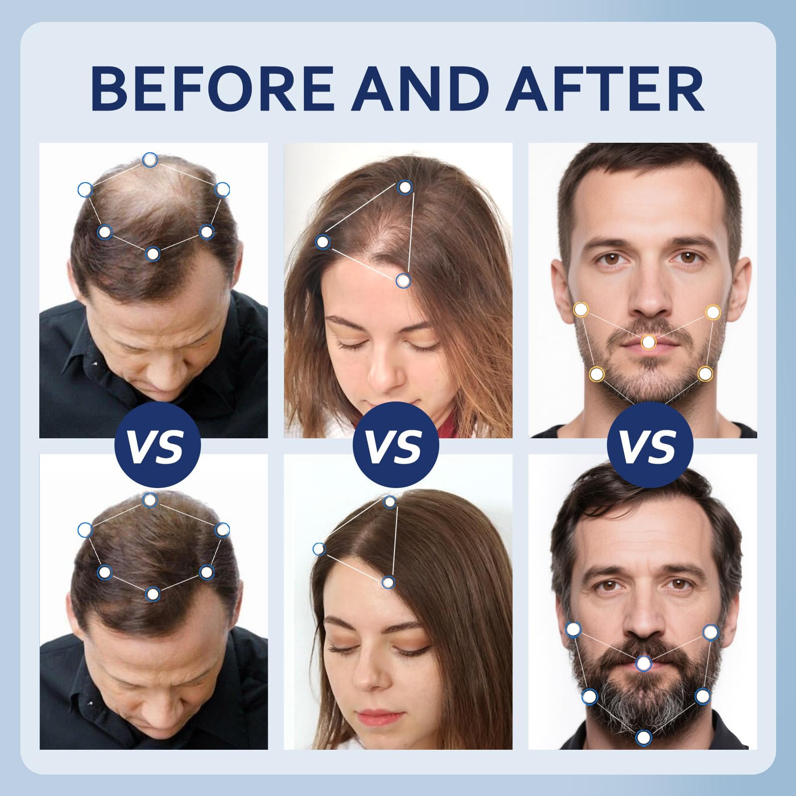 Artimore Minoxidil packaging beside bottle for easy home use.