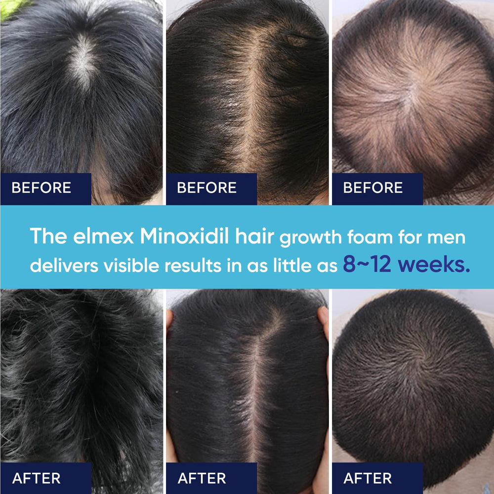 Artimore minoxidil foam ingredients close-up featuring biotin, castor oil, collagen