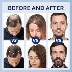 Artimore unscented Minoxidil liquid shown for quick absorption on scalp
